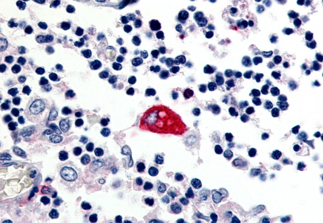 EMR3 Antibody in Immunohistochemistry (Paraffin) (IHC (P))