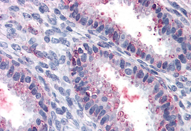 ENTPD2 Antibody in Immunohistochemistry (Paraffin) (IHC (P))