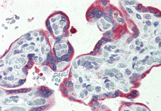 ERP44 Antibody in Immunohistochemistry (Paraffin) (IHC (P))
