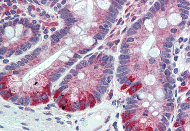 FAM62A Antibody in Immunohistochemistry (Paraffin) (IHC (P))