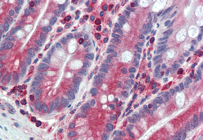 FAM62A Antibody in Immunohistochemistry (Paraffin) (IHC (P))