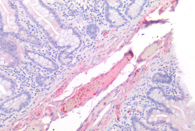 FAP Antibody in Immunohistochemistry (Paraffin) (IHC (P))