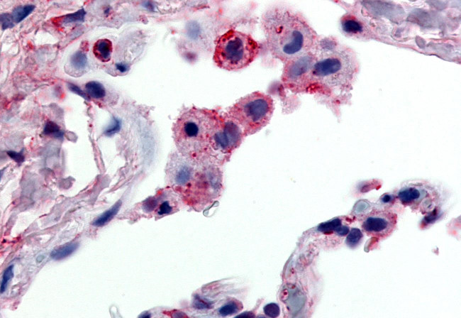 GPR43 Antibody in Immunohistochemistry (Paraffin) (IHC (P))