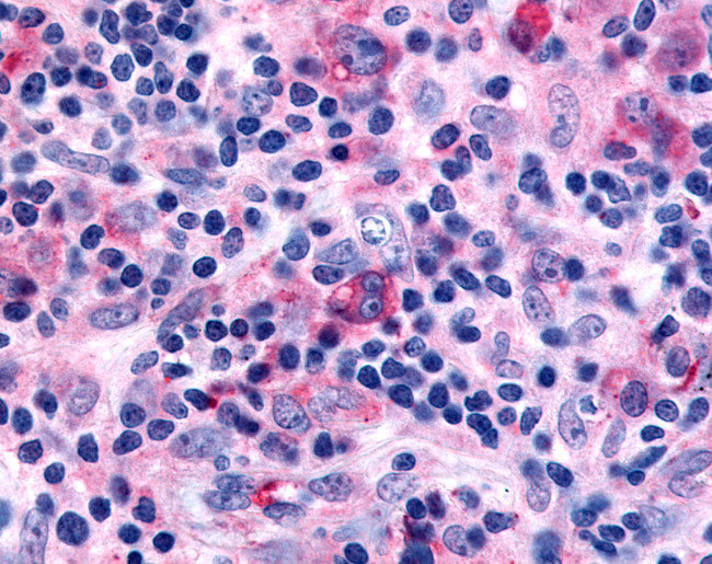 GPR43 Antibody in Immunohistochemistry (Paraffin) (IHC (P))