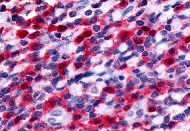 FLT3 Antibody in Immunohistochemistry (Paraffin) (IHC (P))