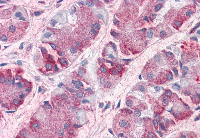 GCNT3 Antibody in Immunohistochemistry (Paraffin) (IHC (P))