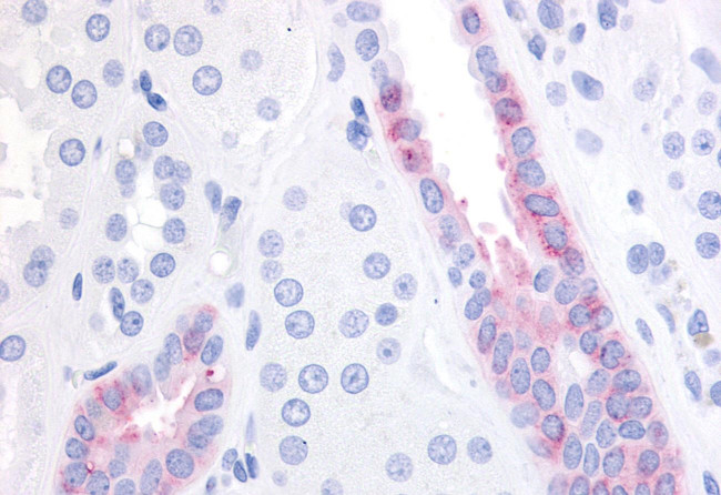 GPR1 Antibody in Immunohistochemistry (Paraffin) (IHC (P))