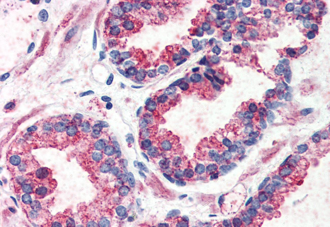 GPR126 Antibody in Immunohistochemistry (Paraffin) (IHC (P))