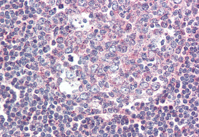 GPR132 Antibody in Immunohistochemistry (Paraffin) (IHC (P))