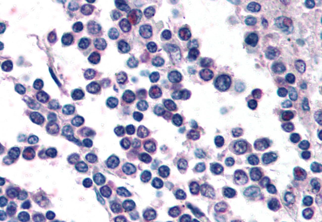 GPR132 Antibody in Immunohistochemistry (Paraffin) (IHC (P))