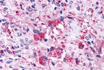 GPR146 Antibody in Immunohistochemistry (Paraffin) (IHC (P))