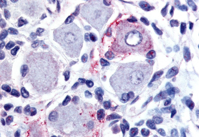 GPR149 Antibody in Immunohistochemistry (Paraffin) (IHC (P))