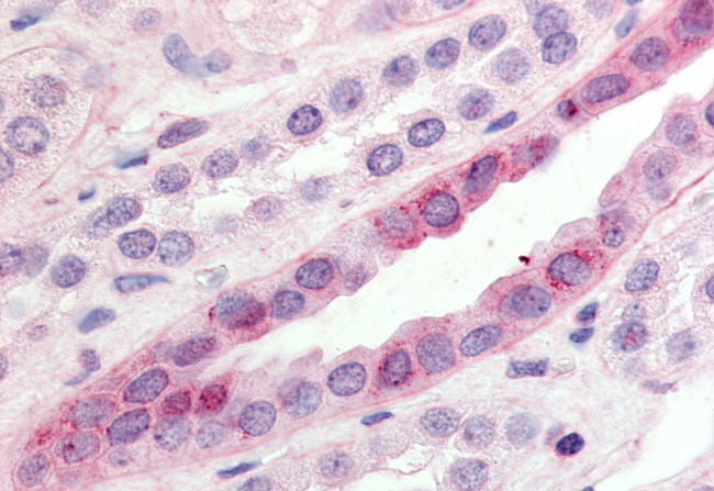 GPR15 Antibody in Immunohistochemistry (Paraffin) (IHC (P))