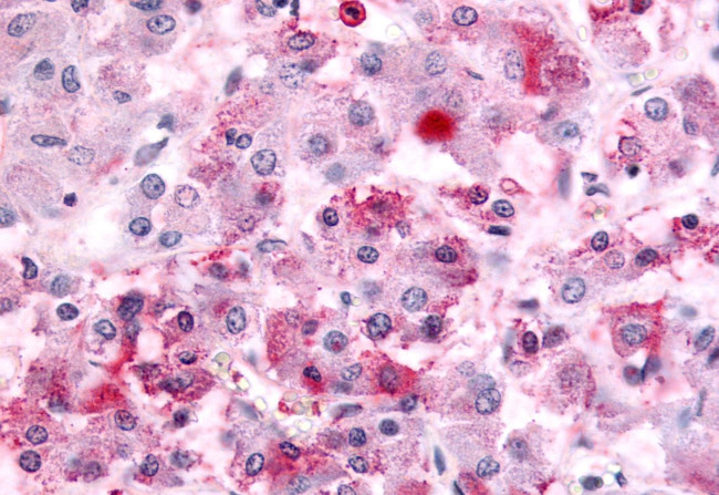 GPR152 Antibody in Immunohistochemistry (Paraffin) (IHC (P))