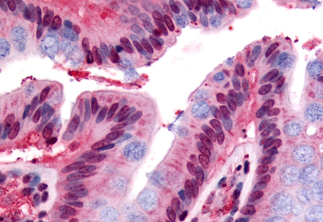 GPR160 Antibody in Immunohistochemistry (Paraffin) (IHC (P))