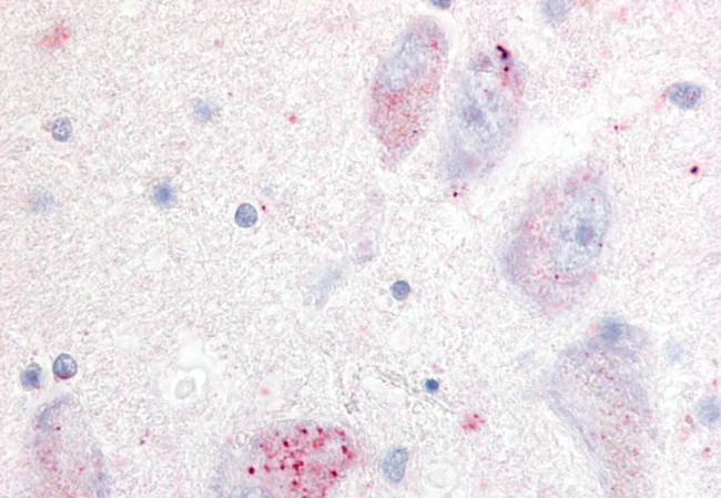 GPR20 Antibody in Immunohistochemistry (Paraffin) (IHC (P))
