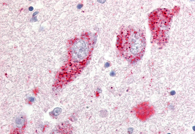 GPR20 Antibody in Immunohistochemistry (Paraffin) (IHC (P))