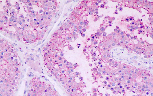 GPR22 Antibody in Immunohistochemistry (Paraffin) (IHC (P))