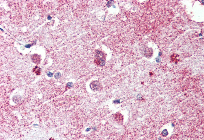 GPR26 Antibody in Immunohistochemistry (Paraffin) (IHC (P))