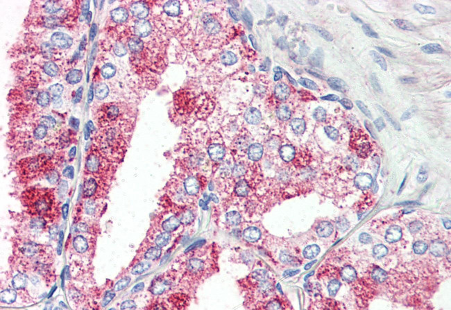 GPR27 Antibody in Immunohistochemistry (Paraffin) (IHC (P))