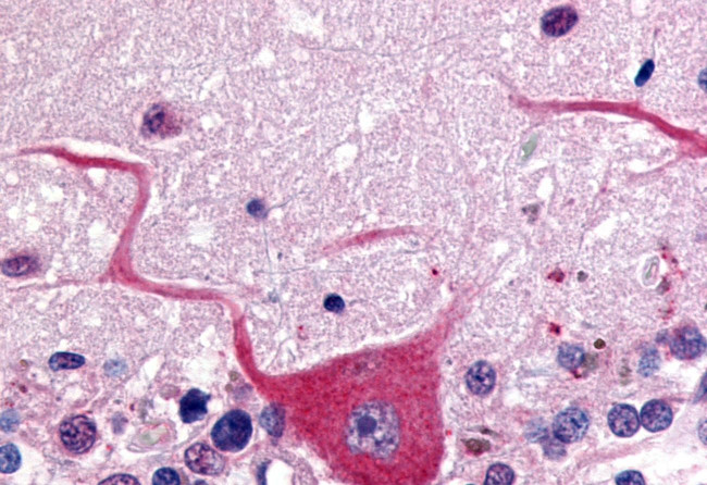 GPR32 Antibody in Immunohistochemistry (Paraffin) (IHC (P))