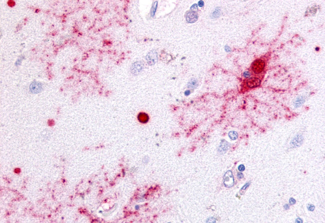 GPR37 Antibody in Immunohistochemistry (Paraffin) (IHC (P))