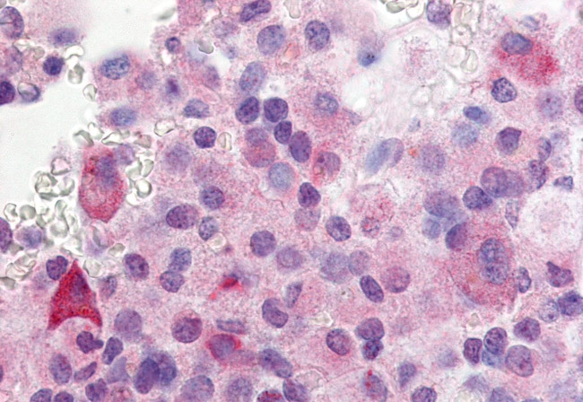 GPR37L1 Antibody in Immunohistochemistry (Paraffin) (IHC (P))