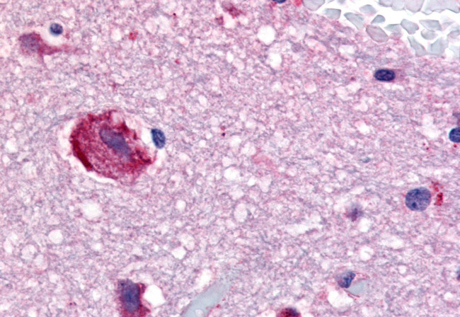 GPR61 Antibody in Immunohistochemistry (Paraffin) (IHC (P))
