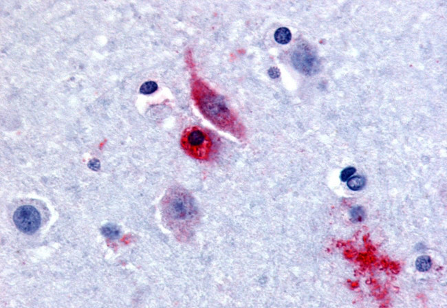 GPR61 Antibody in Immunohistochemistry (Paraffin) (IHC (P))