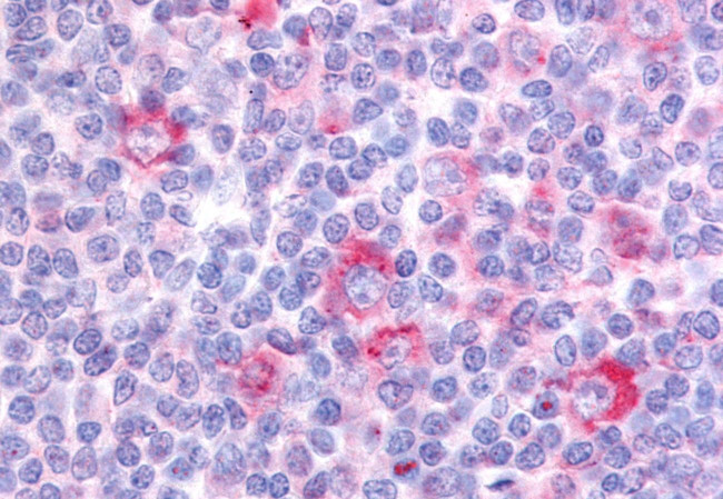 GPR62 Antibody in Immunohistochemistry (Paraffin) (IHC (P))