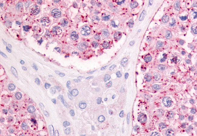 GPR68 Antibody in Immunohistochemistry (Paraffin) (IHC (P))