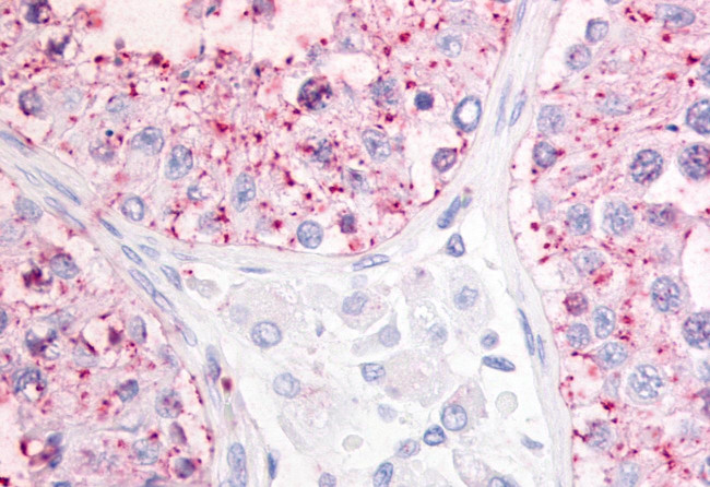 GPR68 Antibody in Immunohistochemistry (Paraffin) (IHC (P))