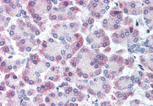 GPRC5C Antibody in Immunohistochemistry (Paraffin) (IHC (P))