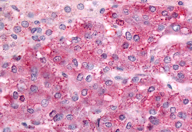 GPRC5C Antibody in Immunohistochemistry (Paraffin) (IHC (P))