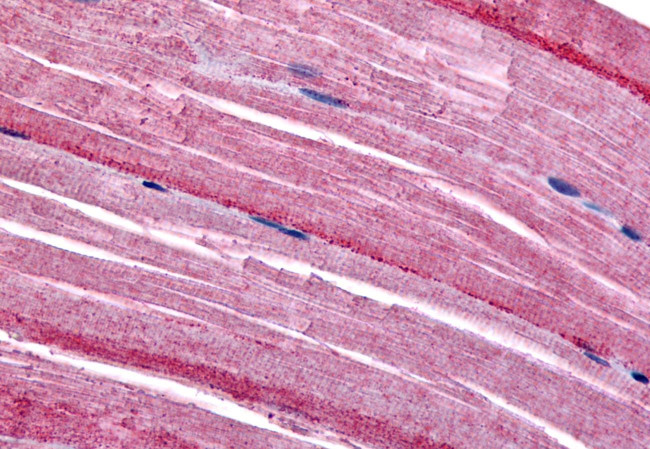GRK5 Antibody in Immunohistochemistry (Paraffin) (IHC (P))