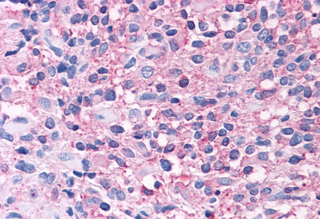 mGluR2 Antibody in Immunohistochemistry (Paraffin) (IHC (P))