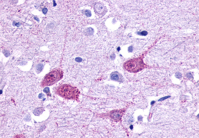 HTR1F Antibody in Immunohistochemistry (Paraffin) (IHC (P))