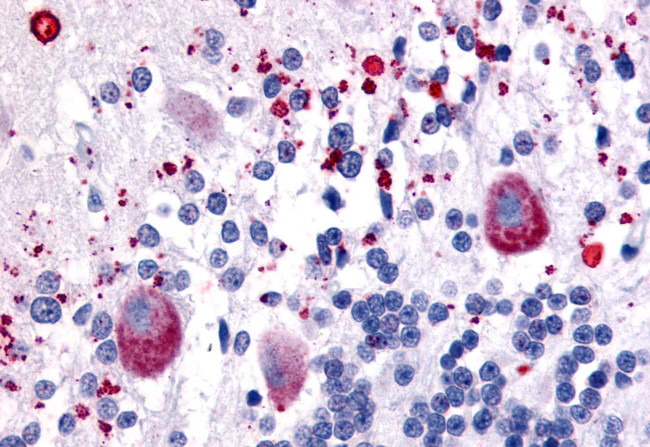 HTR7 Antibody in Immunohistochemistry (Paraffin) (IHC (P))