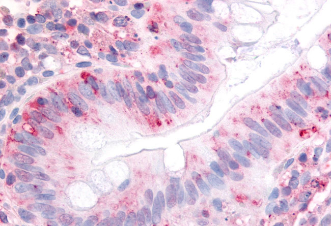 ITGA2 Antibody in Immunohistochemistry (Paraffin) (IHC (P))