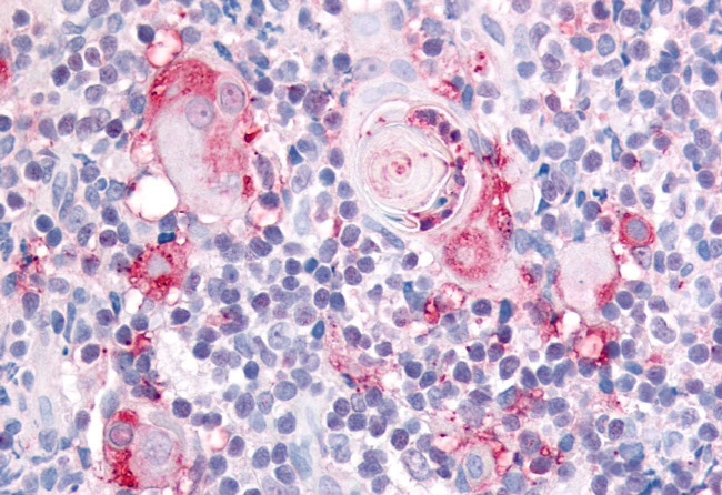ITGA2 Antibody in Immunohistochemistry (Paraffin) (IHC (P))
