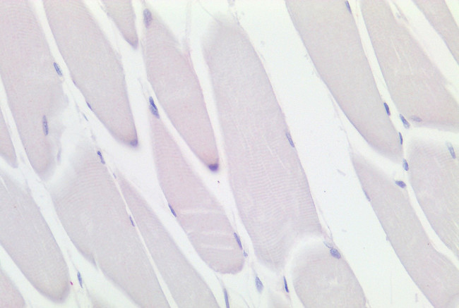 CD11c Antibody in Immunohistochemistry (Paraffin) (IHC (P))