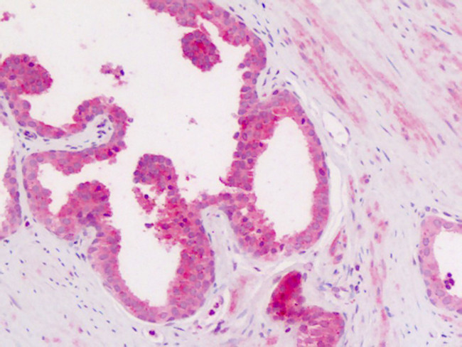 CD11c Antibody in Immunohistochemistry (Paraffin) (IHC (P))