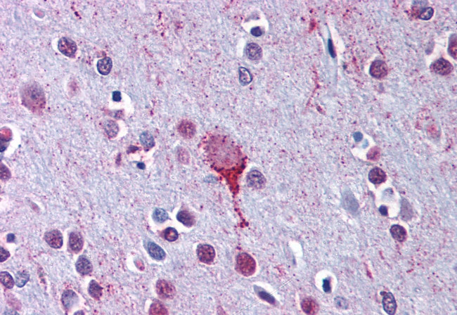 LPAR4 Antibody in Immunohistochemistry (Paraffin) (IHC (P))