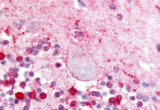 LPAR5 Antibody in Immunohistochemistry (Paraffin) (IHC (P))