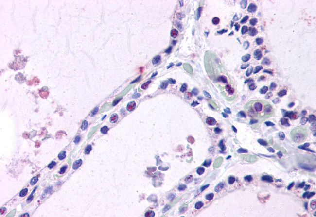 LPCAT1 Antibody in Immunohistochemistry (Paraffin) (IHC (P))