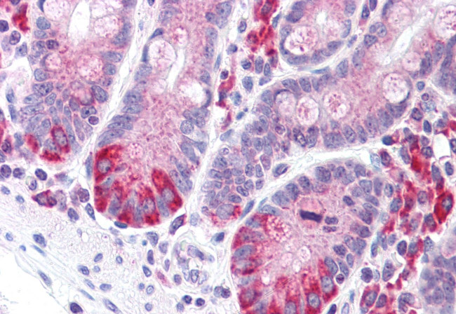 LRRN4 Antibody in Immunohistochemistry (Paraffin) (IHC (P))