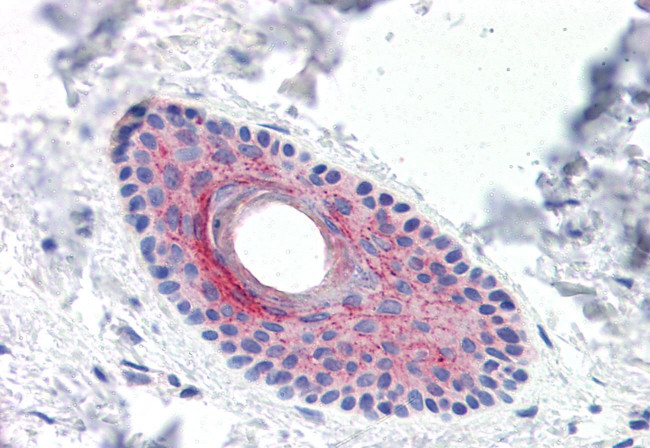 LYPD3 Antibody in Immunohistochemistry (Paraffin) (IHC (P))