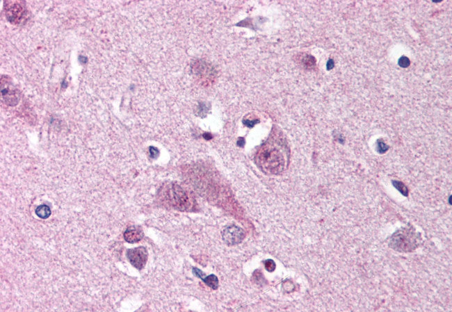 MARK1 Antibody in Immunohistochemistry (Paraffin) (IHC (P))