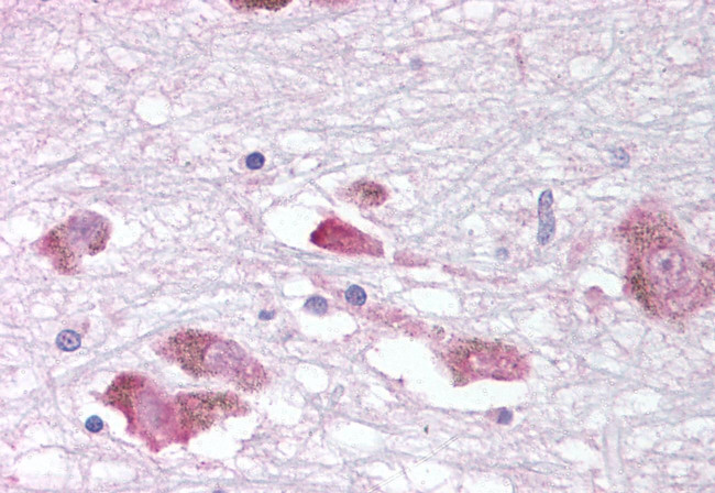MCHR1 Antibody in Immunohistochemistry (Paraffin) (IHC (P))