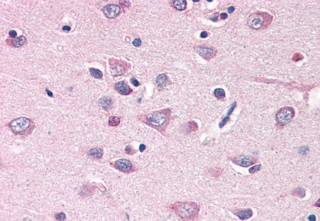 MFI2 Antibody in Immunohistochemistry (Paraffin) (IHC (P))
